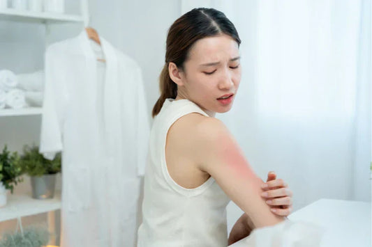 how to calm inflamed skin with KawaKawa Balm