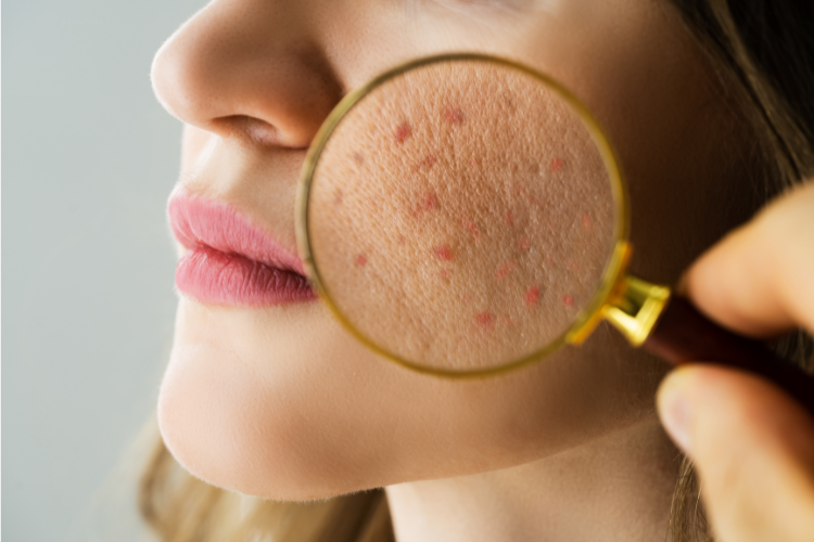 The Skin Microbiome: Your Invisible Skin Barrier