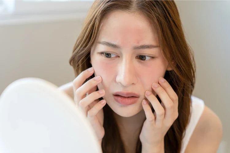 Blush or Burn? Quick Tips to Calm Redness in Sensitive Skin