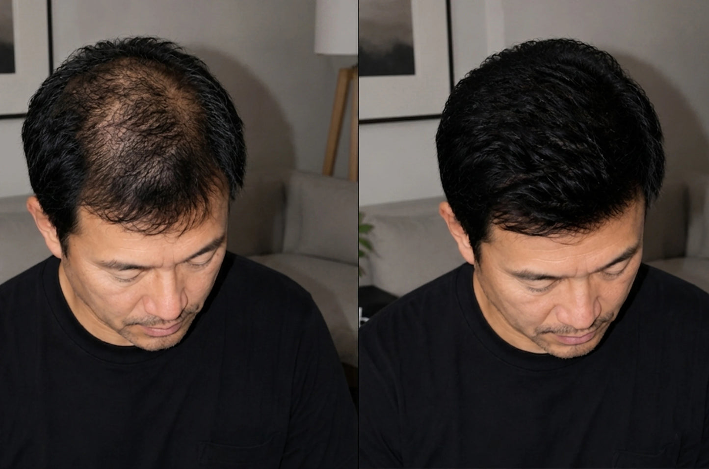 Hair Growth Serum
